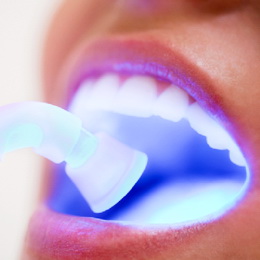 Новая методика отбеливания зубов
