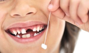 лікування молочних зубів